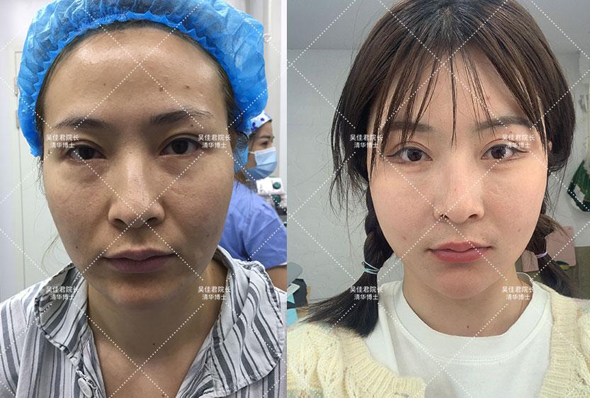 广安_118开奖站 澳门,扒皮社区的全面释义、解释与落实